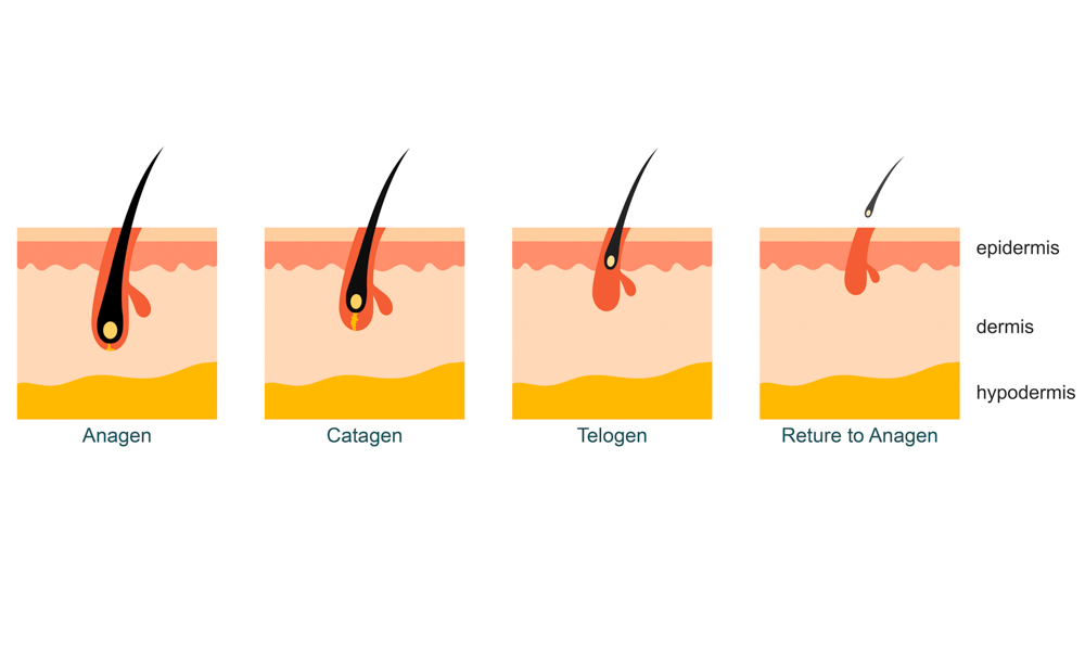 Chemotherapy related hair loss  Best treatments  MDhair